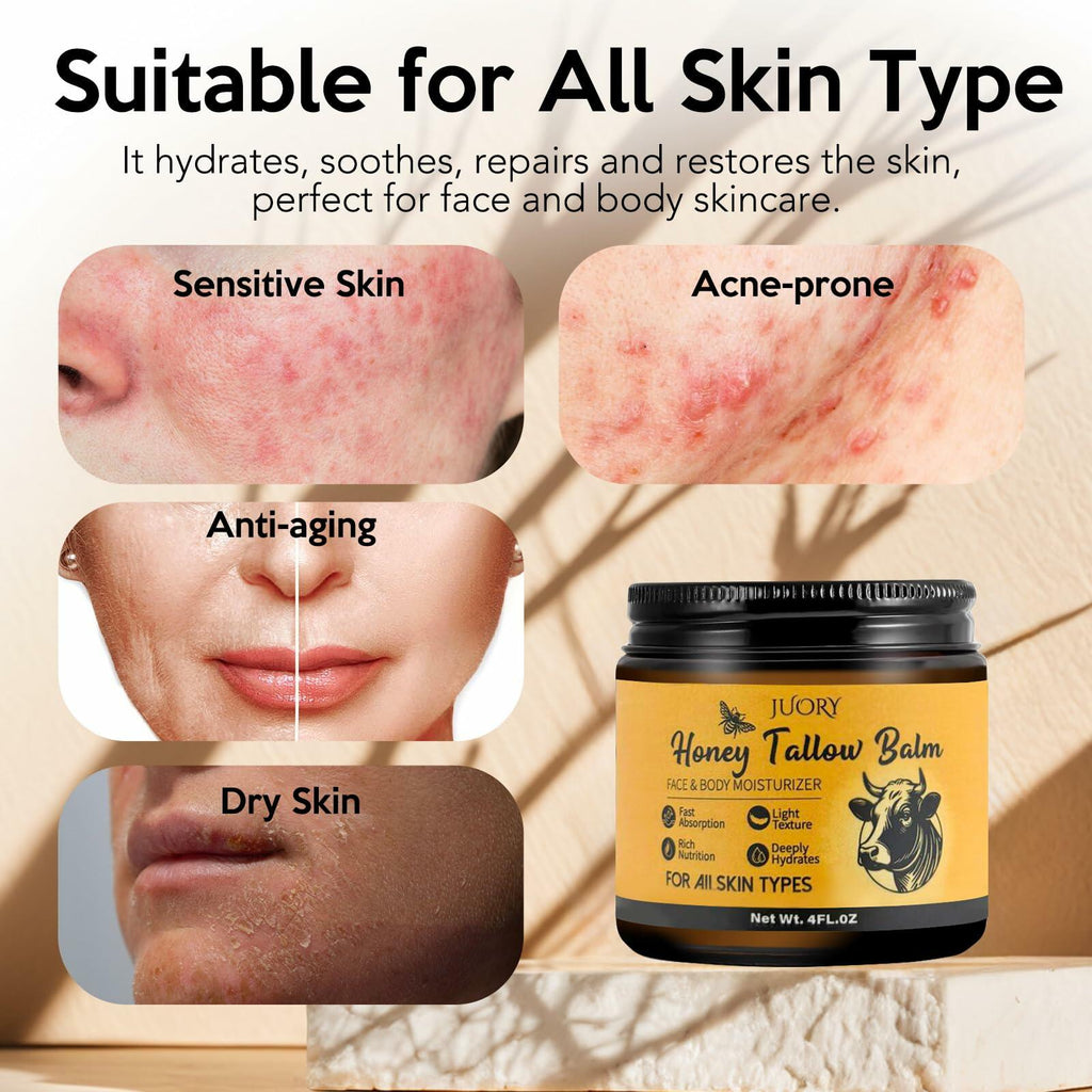 BestBy07/28 Juory Beef Tallow Balm Skin Moisturizer 4oz Honey Calendula Tea Tree