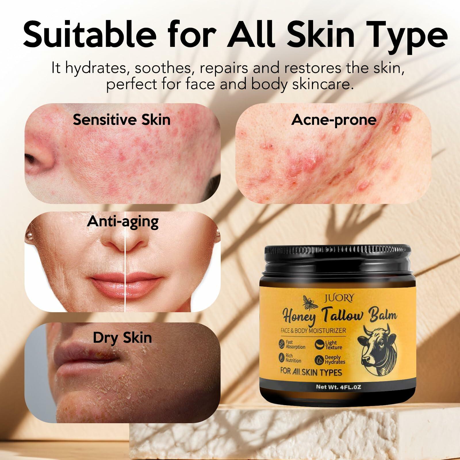 BestBy07/28 Juory Beef Tallow Balm Skin Moisturizer 4oz Honey Calendula Tea Tree